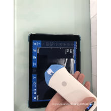 Cheapest USB 2D Portable Ultrasound Probe Linear Convex Scanner with Ce/ISO